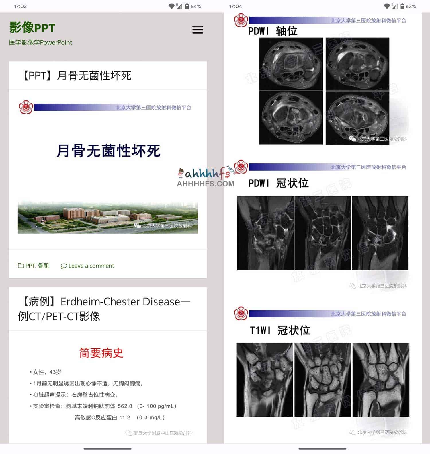 医学影像ppt资源下载中心 - 影像PPT